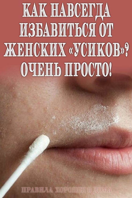 Как навсегда избавиться от женских &laquo;усиков&raquo;? Очень просто!