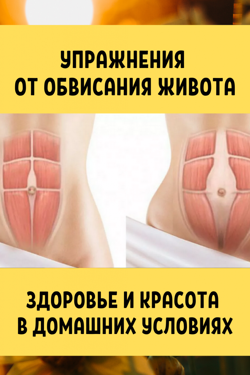 Упражнения от диастаза, от обвисания живота для женщин.
