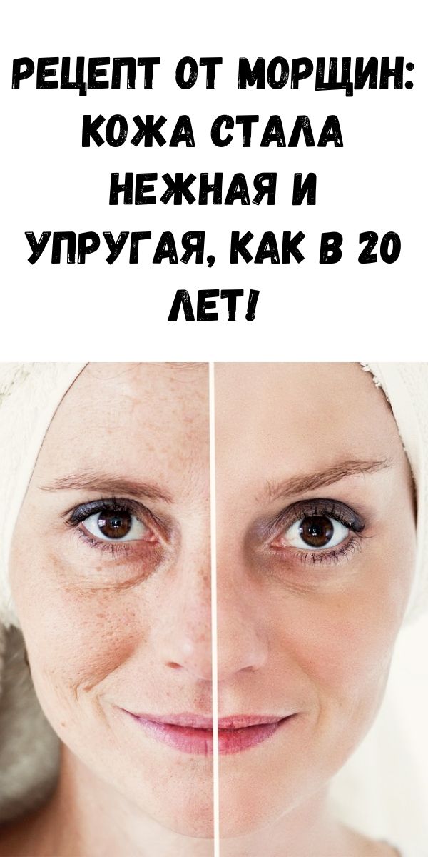 Рецепт от морщин: кожа стала нежная и упругая, как в 20 лет!
