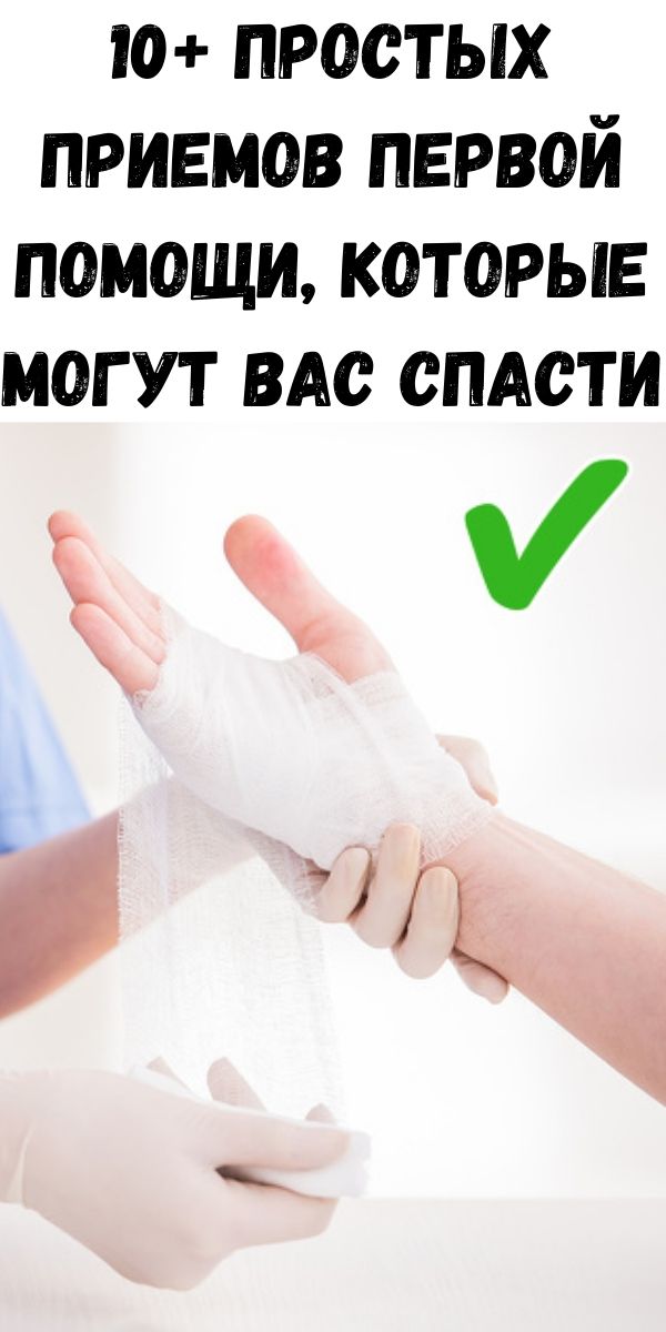 10+ простых приемов первой помощи, которые могут вас спасти