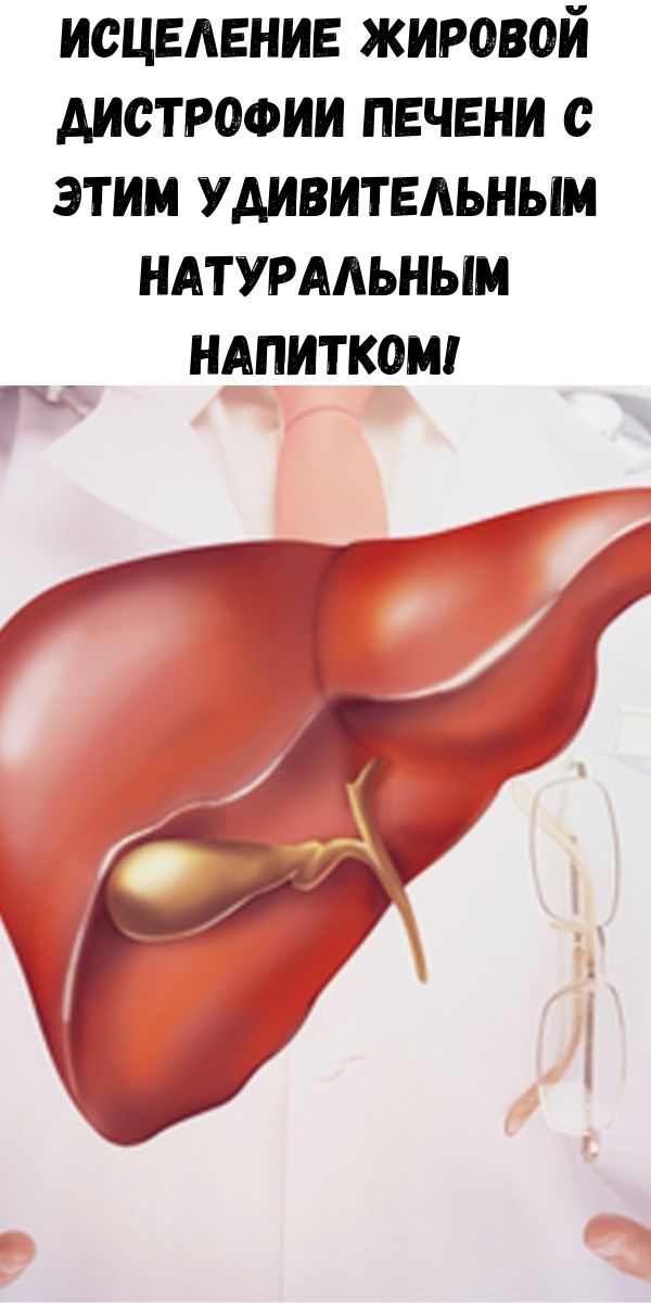 Исцеление жировой дистрофии печени с этим удивительным натуральным напитком!