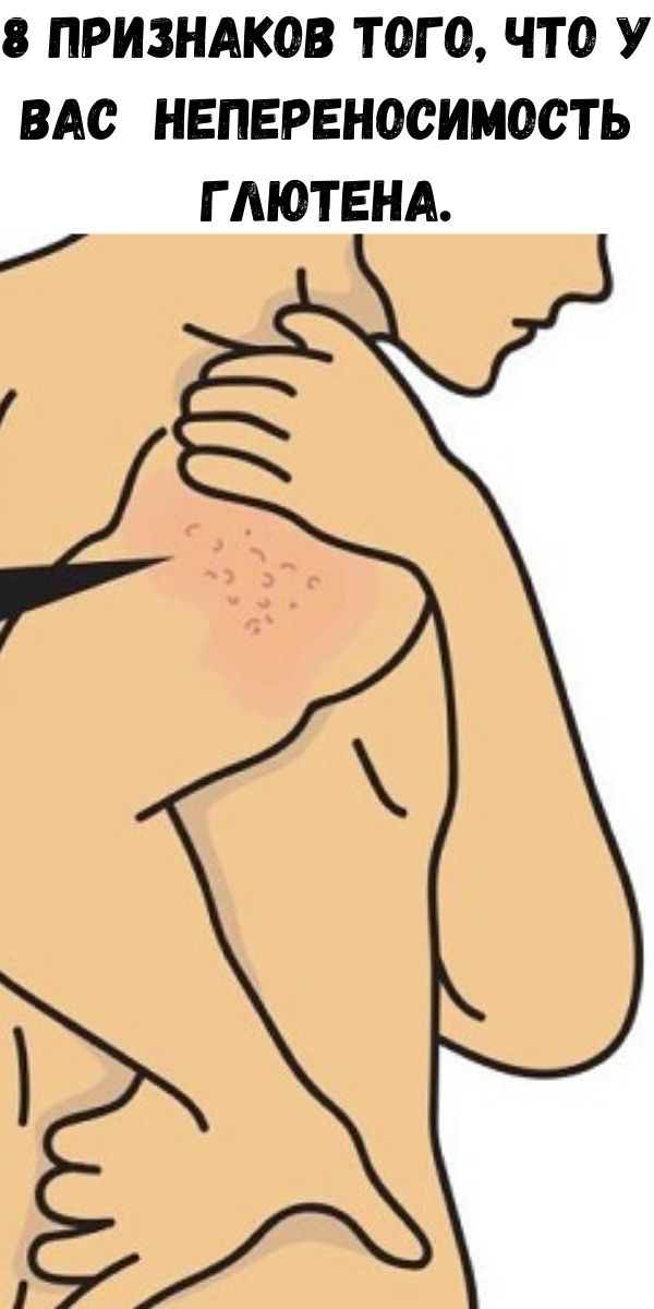 8 признаков того, что у вас непереносимость глютена.