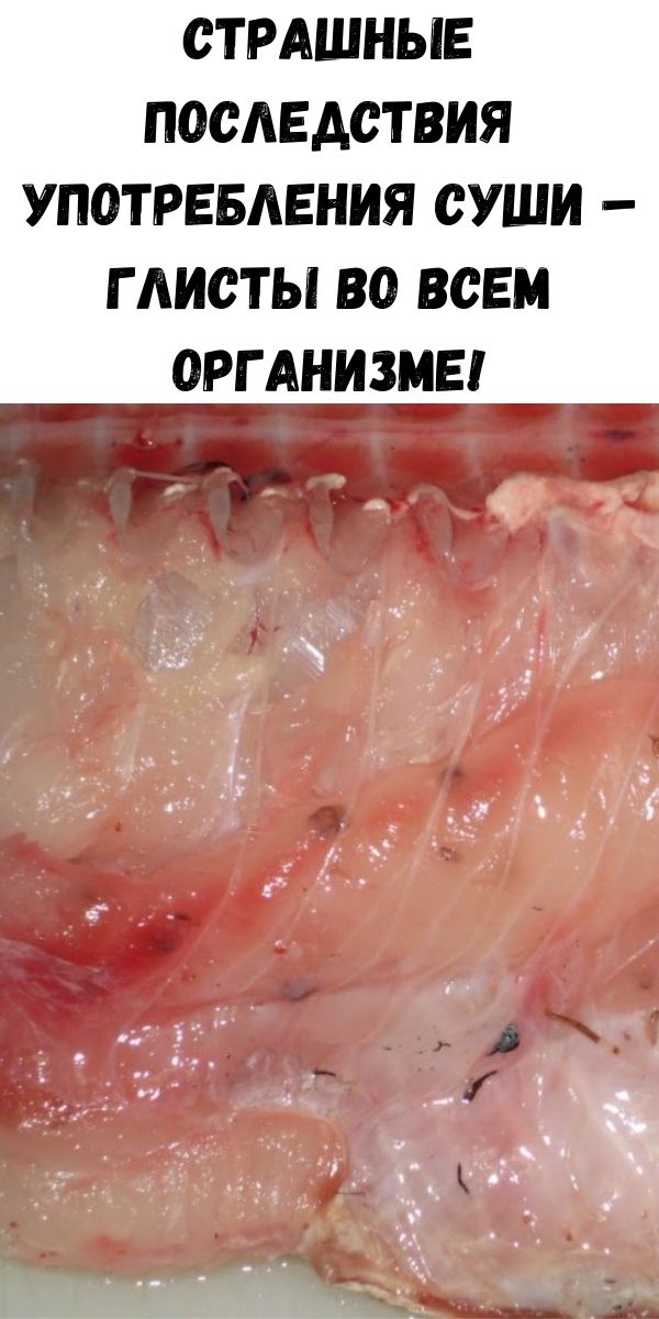 Страшные последствия употребления суши &ndash; глисты во всем организме!