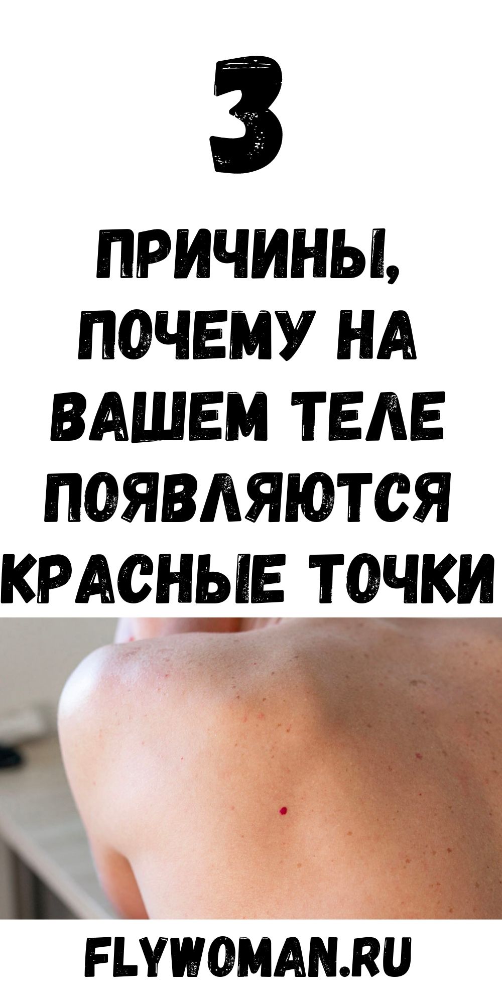 У вас есть красные точки на теле? Знайте — это симптом Тужилина!