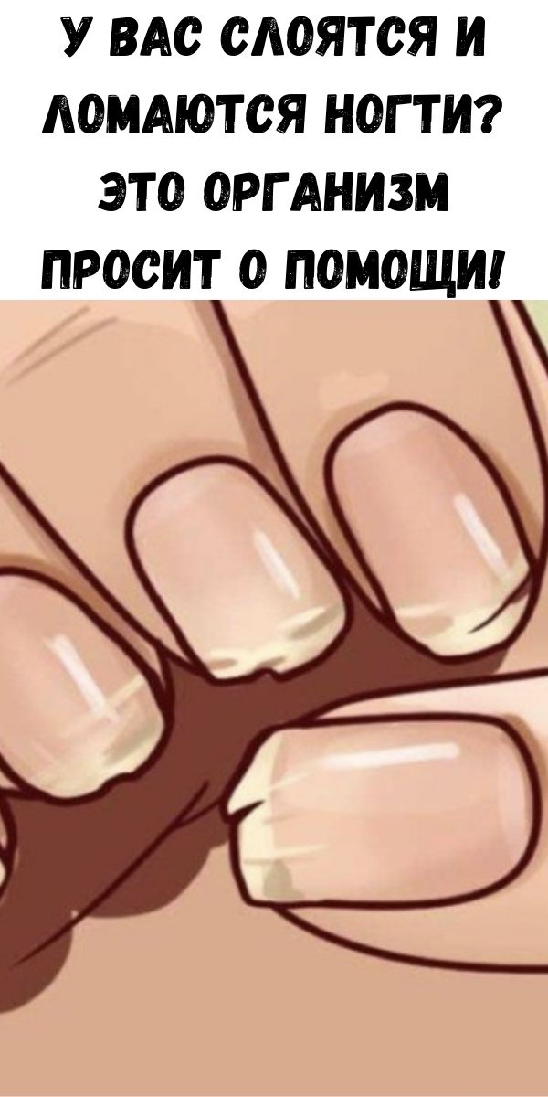 У вас слоятся и ломаются ногти? Это организм просит о помощи!