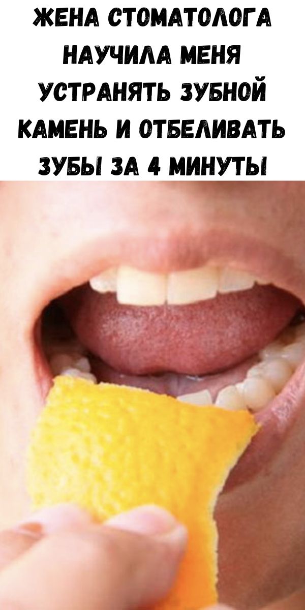 Жена стоматолога научила меня устранять зубной камень и отбеливать зубы за 4 минуты