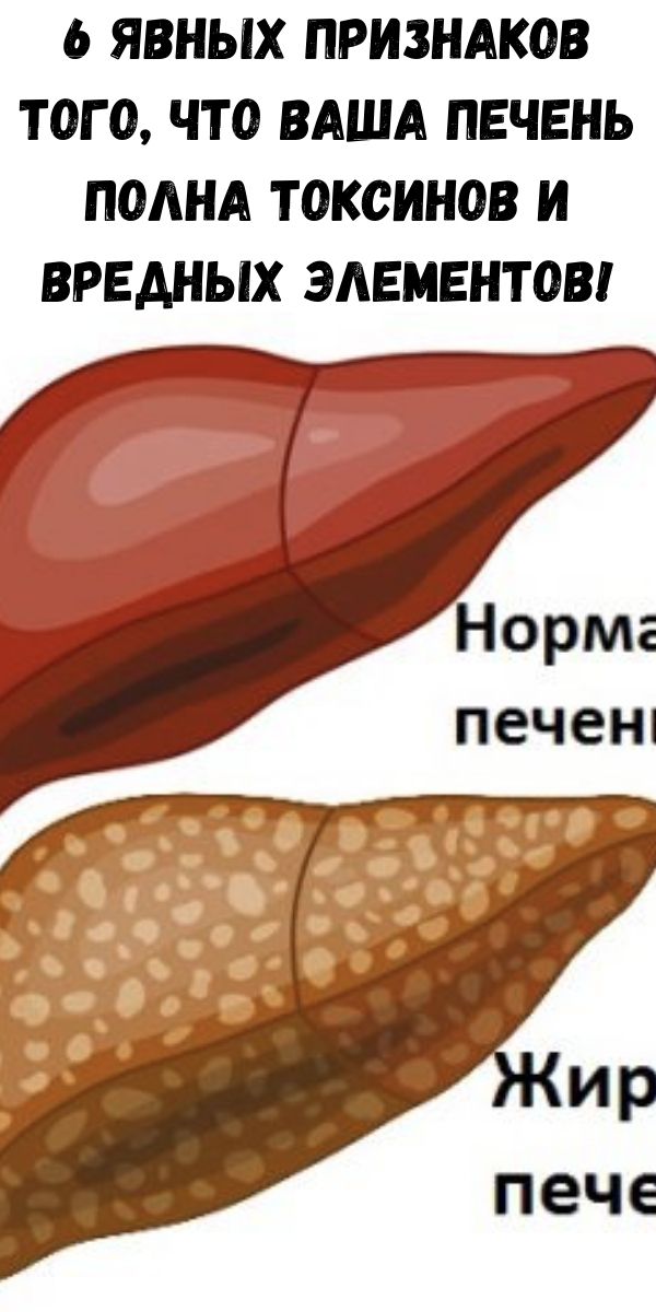 6 явных признаков того, что Ваша печень полна токсинов и вредных элементов!