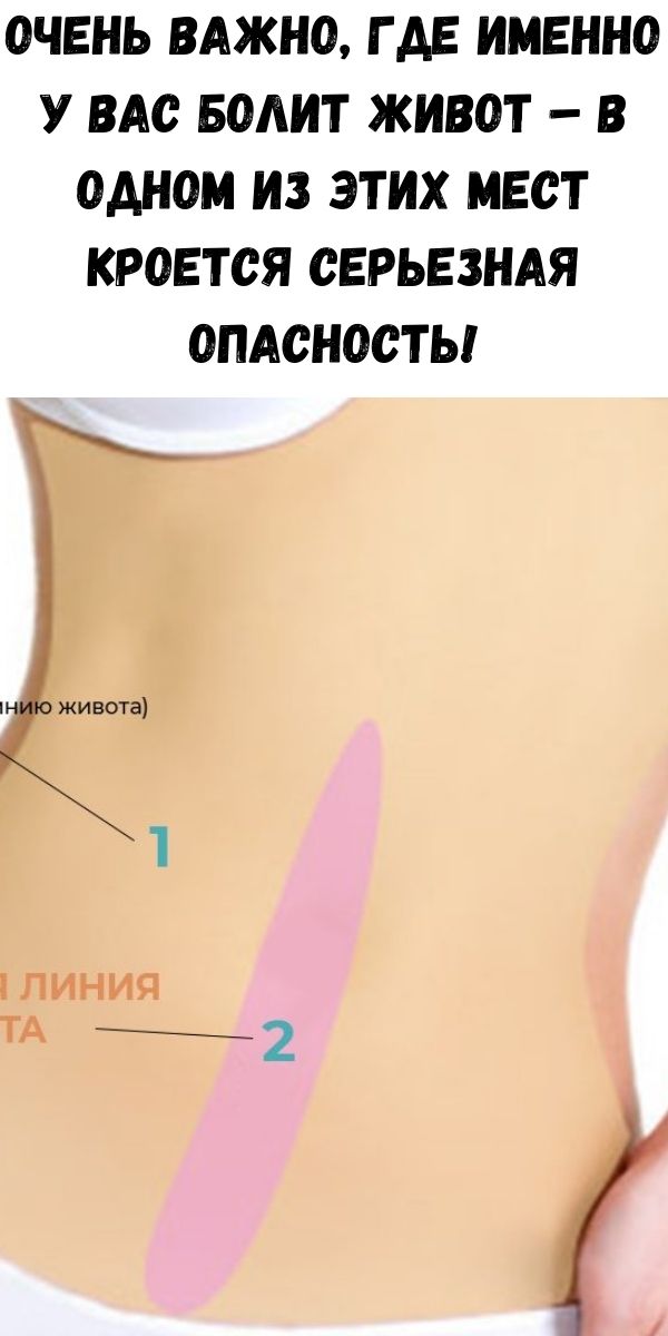 Очень важно, где именно у Вас болит живот &ndash; в одном из этих мест кроется серьезная опасность!