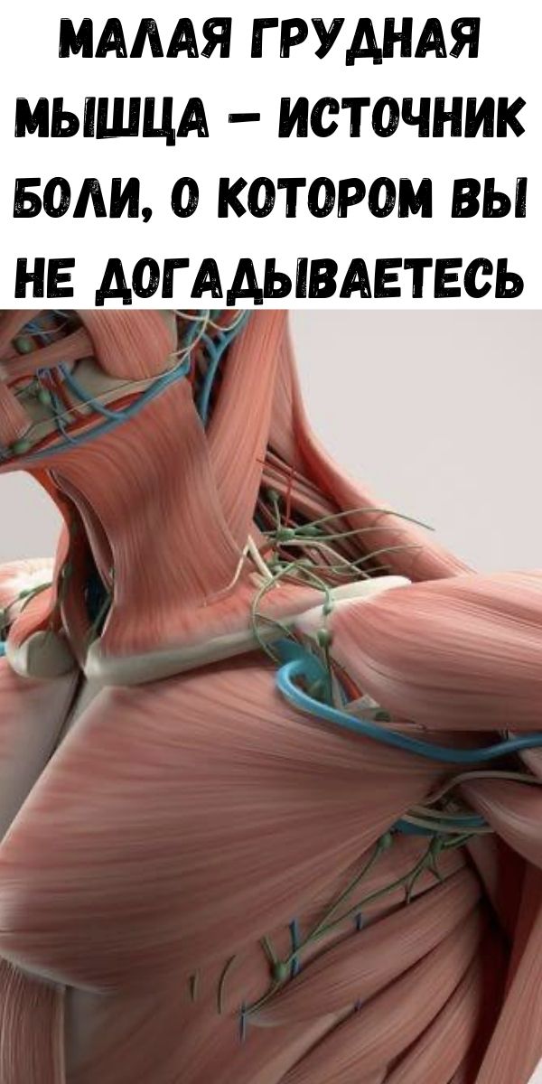 Малая грудная мышца &ndash; источник боли, о котором Вы не догадываетесь
