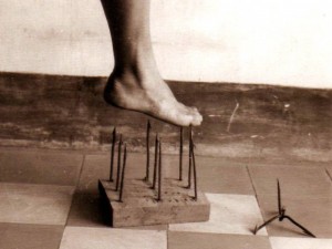 10 странных заболеваний, о которых вы никогда не слышали 10 странных заболеваний, о которых вы никогда не слышали