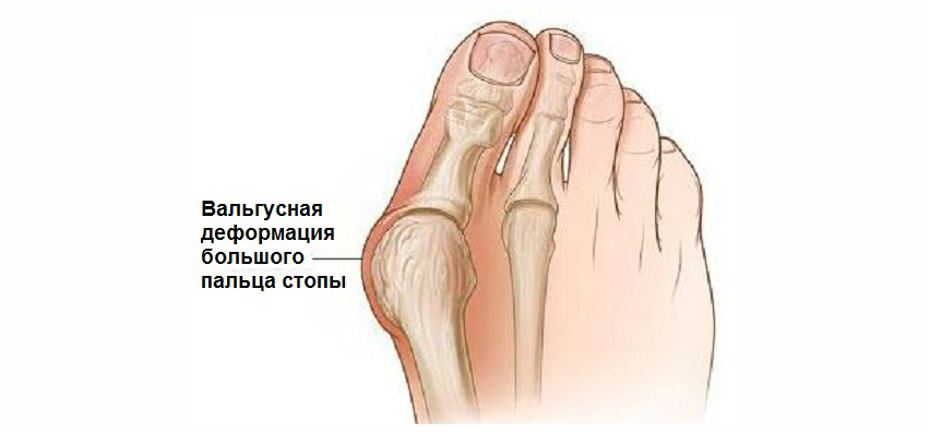 ВЫЛЕЧИТЬ 