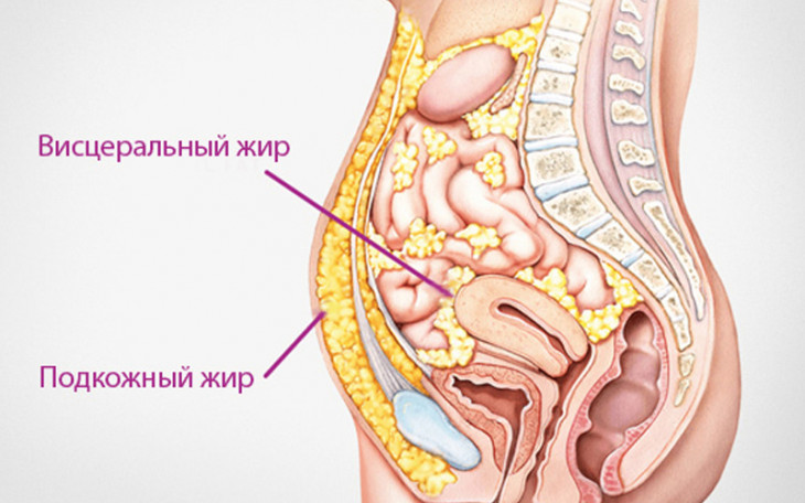 Опасность висцерального жира в брюшной полости. Как от него избавиться Опасность висцерального жира в брюшной полости. Как от него избавиться